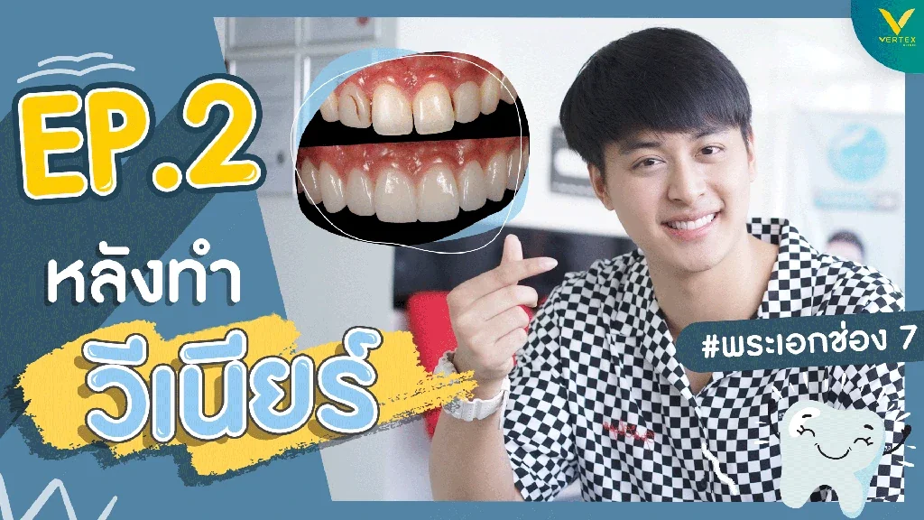 วีเนียร์ฟันดาราไม่ใช่แค่เรื่องของความสวย