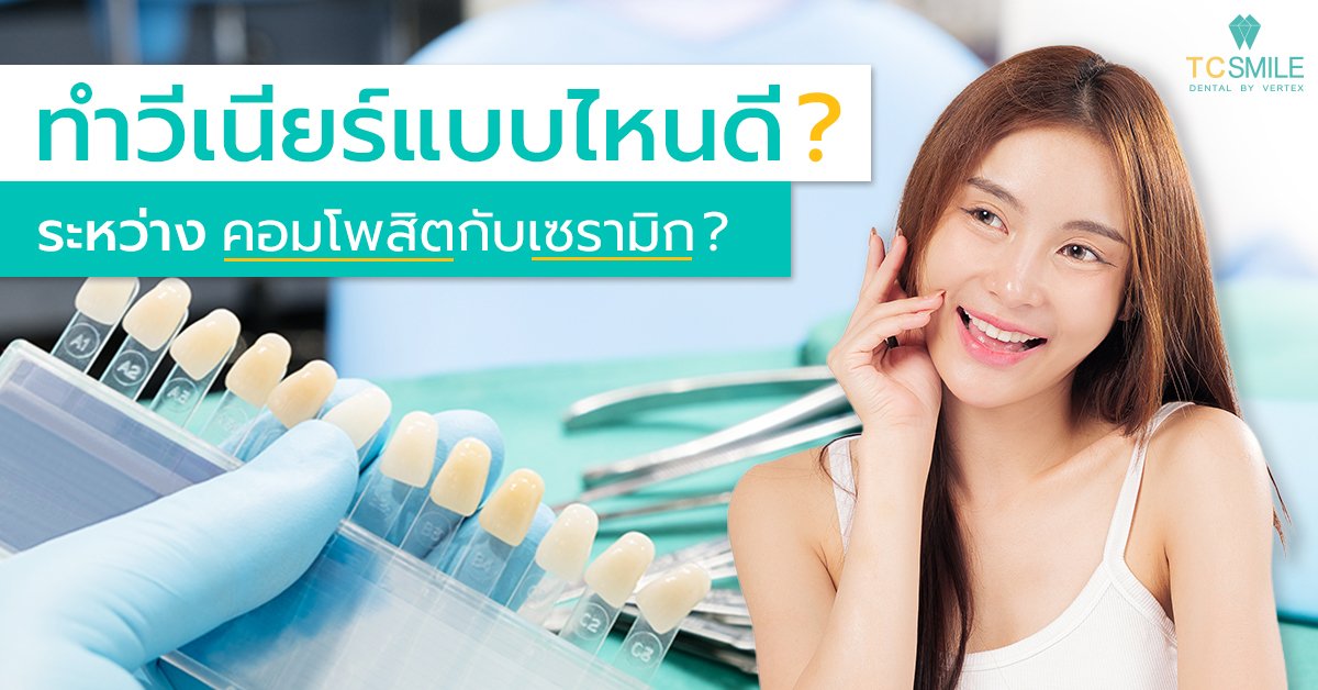 ทำวีเนียร์แบบไหนดี ระหว่างแบบคอมโพสิตกับแบบเซรามิก