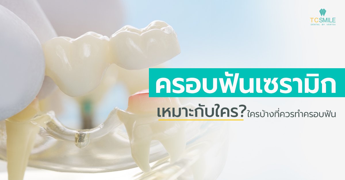 ครอบฟันเซรามิก เหมาะกับใครบ้าง ใครบ้างที่ควรทำครอบฟัน