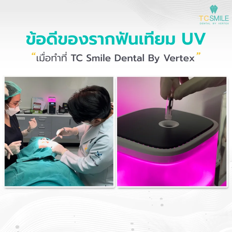 ข้อดีของรากฟันเทียม UV (เมื่อทำที่ TC Smile Dental By Vertex)