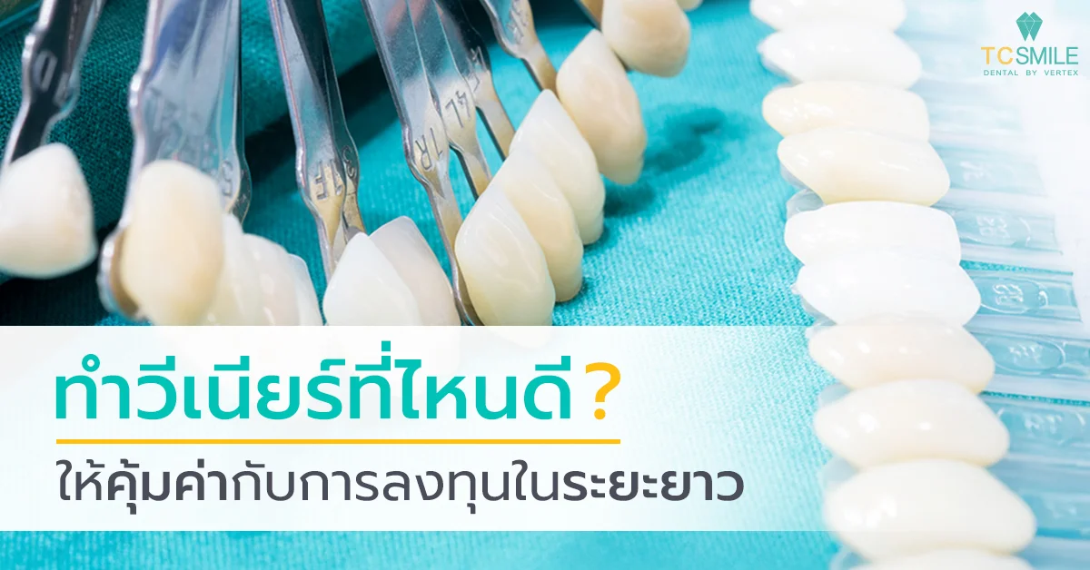 ทำวีเนียร์ที่ไหนดี ให้คุ้มค่ากับการลงทุนในระยะยาว