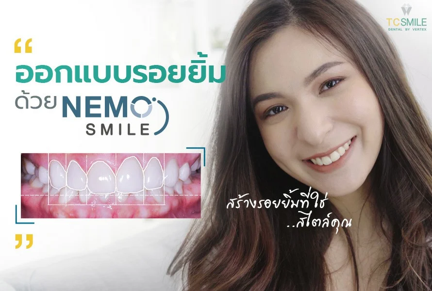 ทำไมการออกแบบด้วยเทคนิค Nemo Smile ถึงดีกว่าเดิม