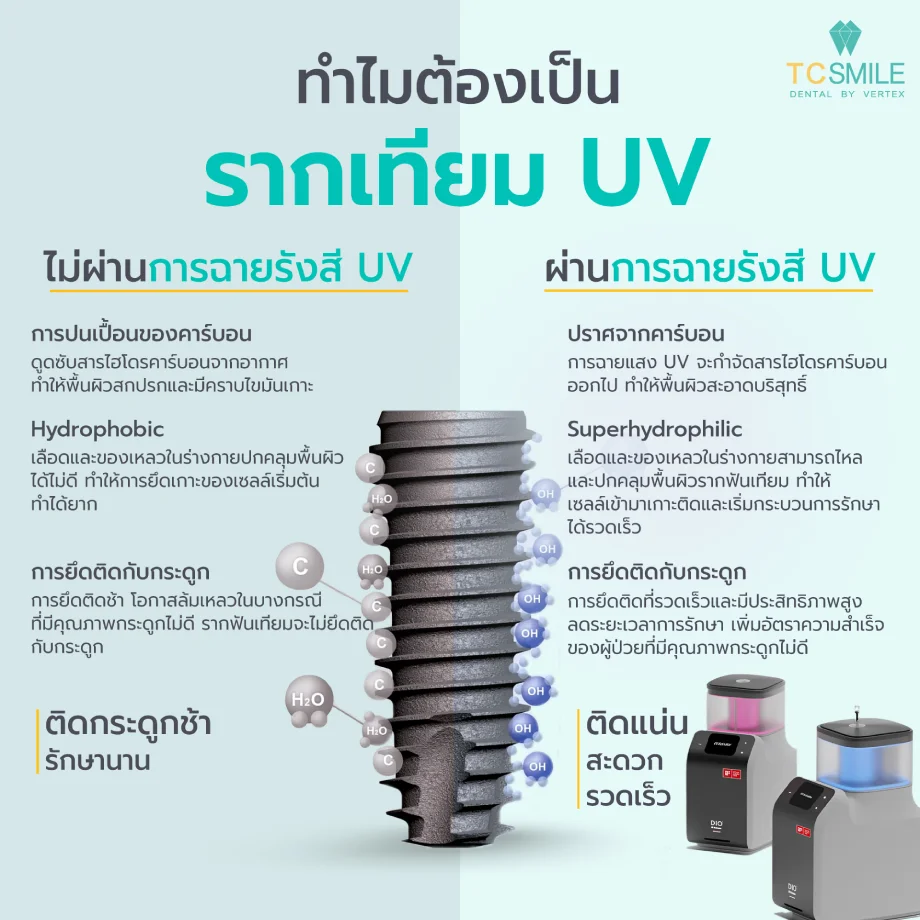 ทำไมต้องเป็นรากฟันเทียมUV