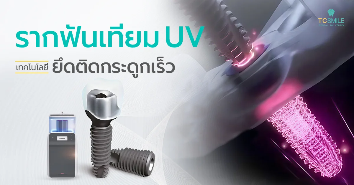 รากฟันเทียม UV