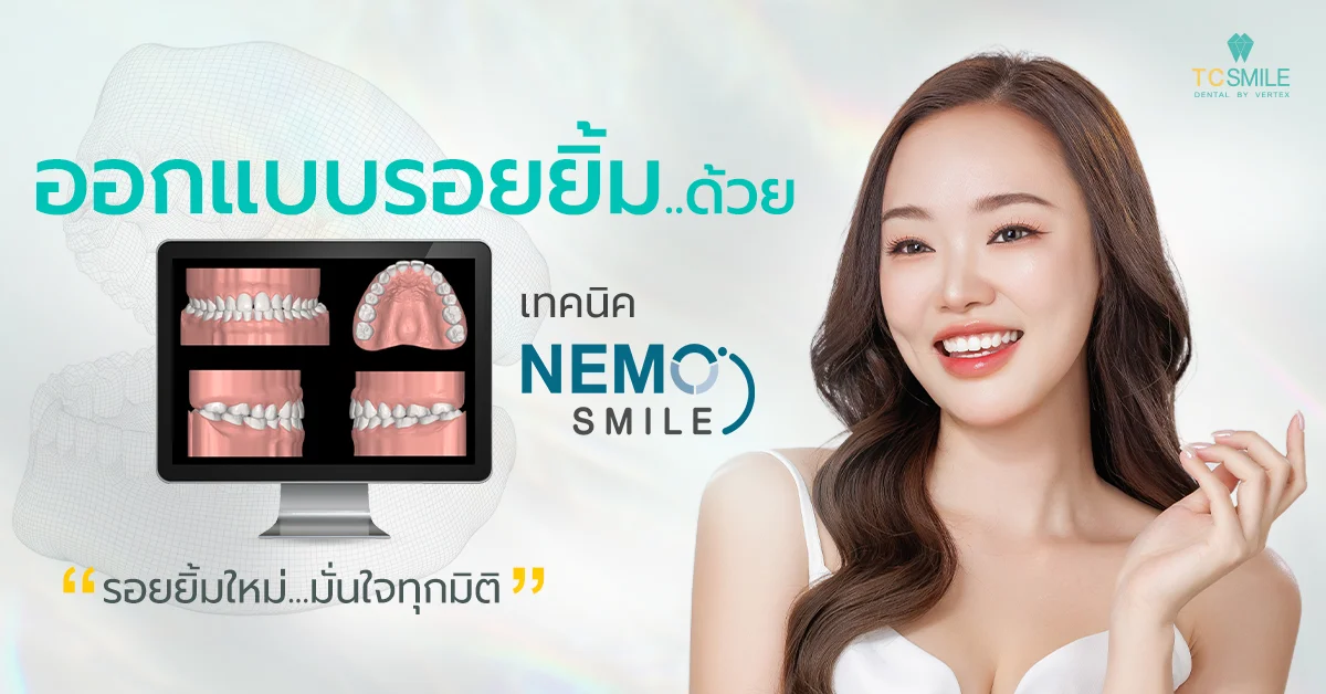 ออกแบบรอยยิ้มด้วย เทคนิค Nemo Smile