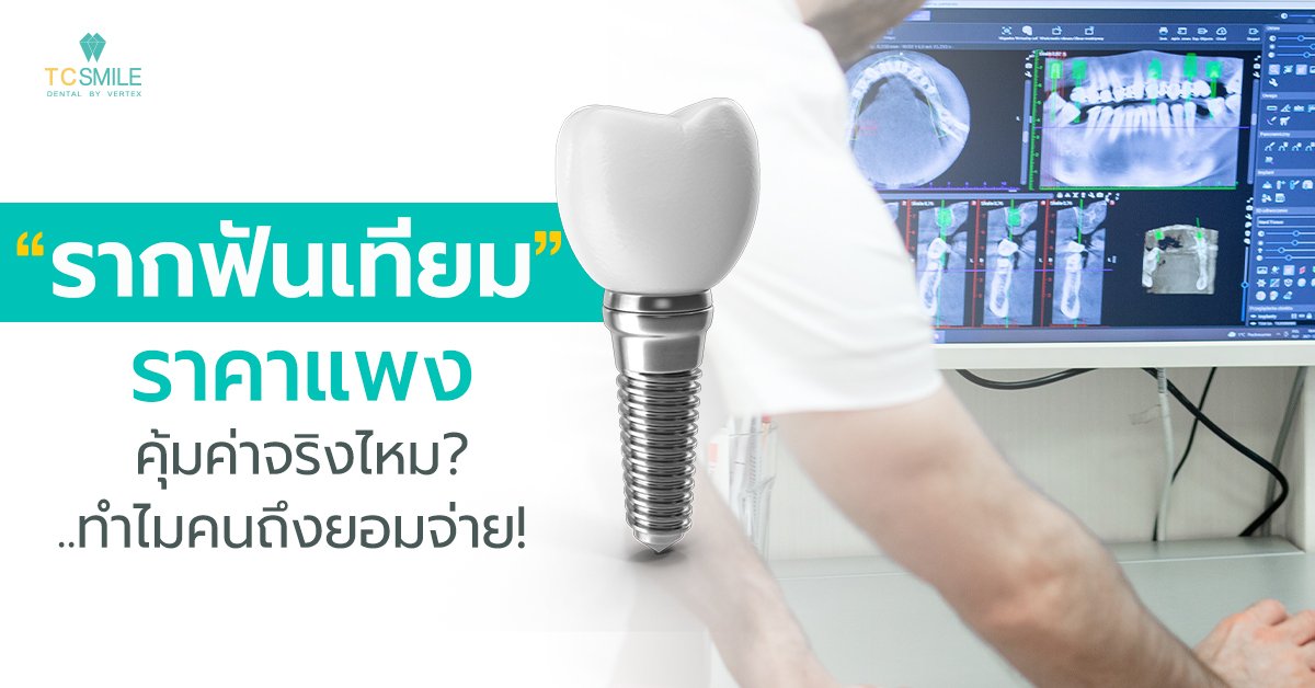 รากฟันเทียมราคาแพง…คุ้มค่าจริงไหม ทำไมคนถึงยอมจ่าย!