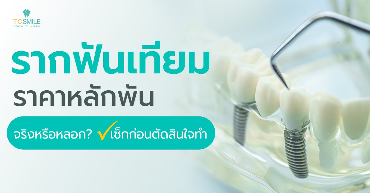 รากฟันเทียมราคาหลักพัน จริงหรือหลอก เช็กก่อนตัดสินใจทำ