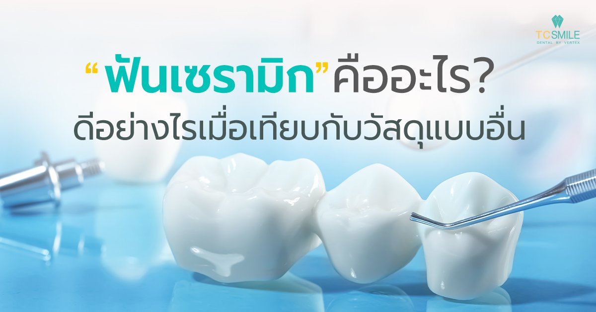 ฟันเซรามิกคืออะไร ดีอย่างไรเมื่อเทียบกับวัสดุแบบอื่น