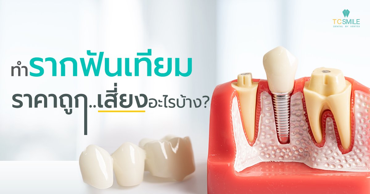 ทำรากฟันเทียมราคาถูกเสี่ยงอะไรบ้าง รู้ไว้ก่อนตัดสินใจทำ