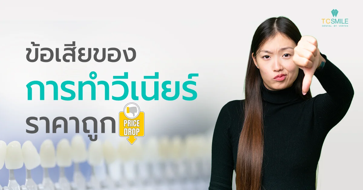 ข้อเสียของการทำวีเนียร์ราคาถูก