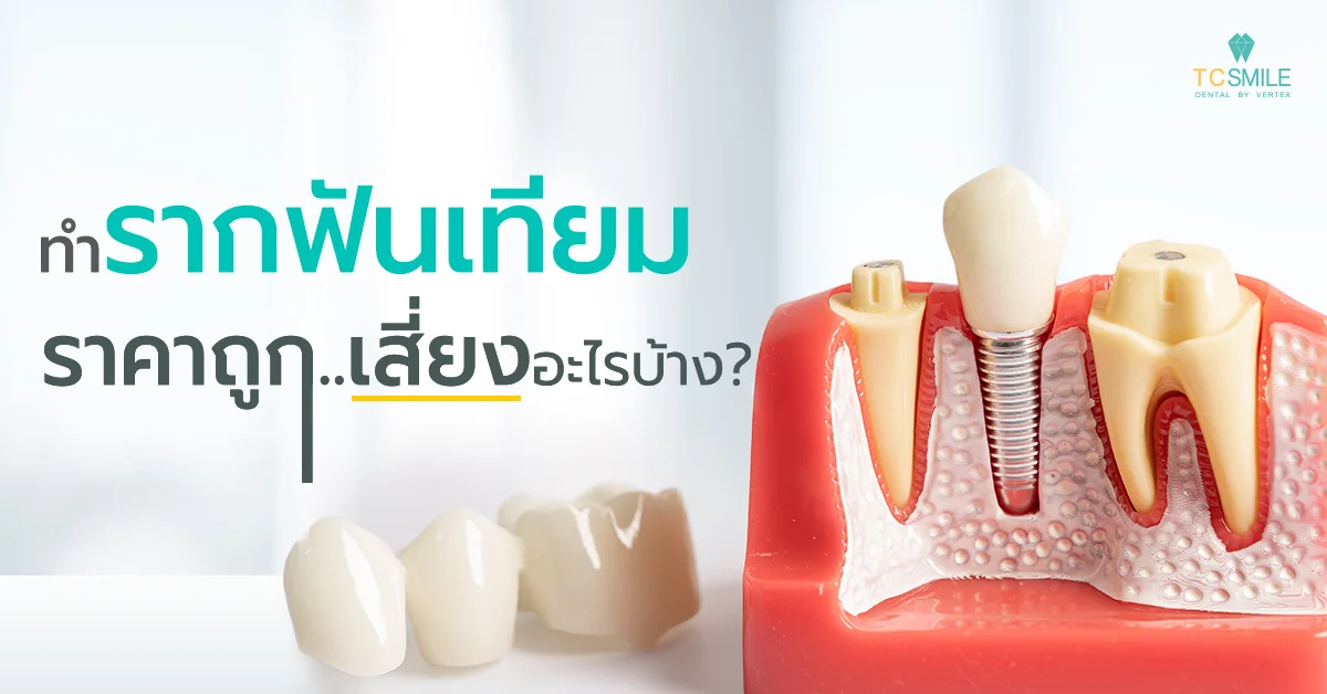 ทำรากฟันเทียมราคาถูกเสี่ยงอะไรบ้าง