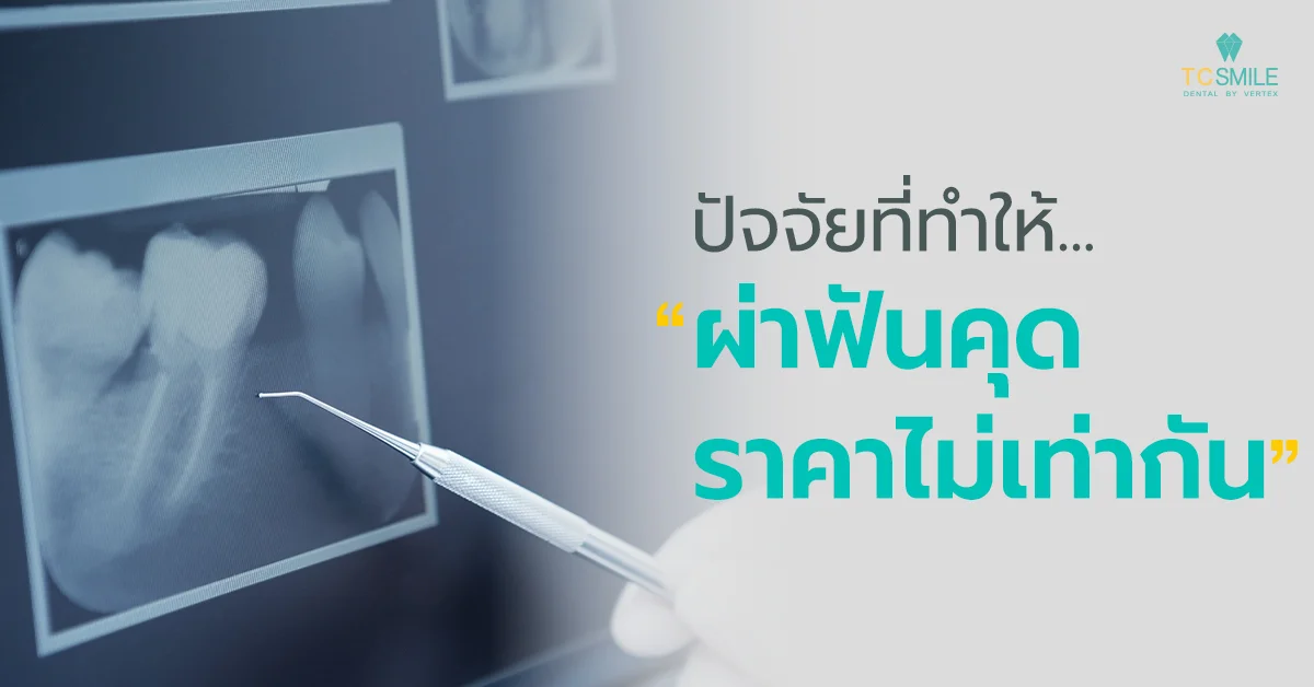 ปัจจัยที่ทำให้ผ่าฟันคุดราคาไม่เท่ากัน