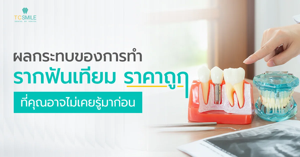 ผลกระทบของการทำรากฟันเทียมราคาถูก
