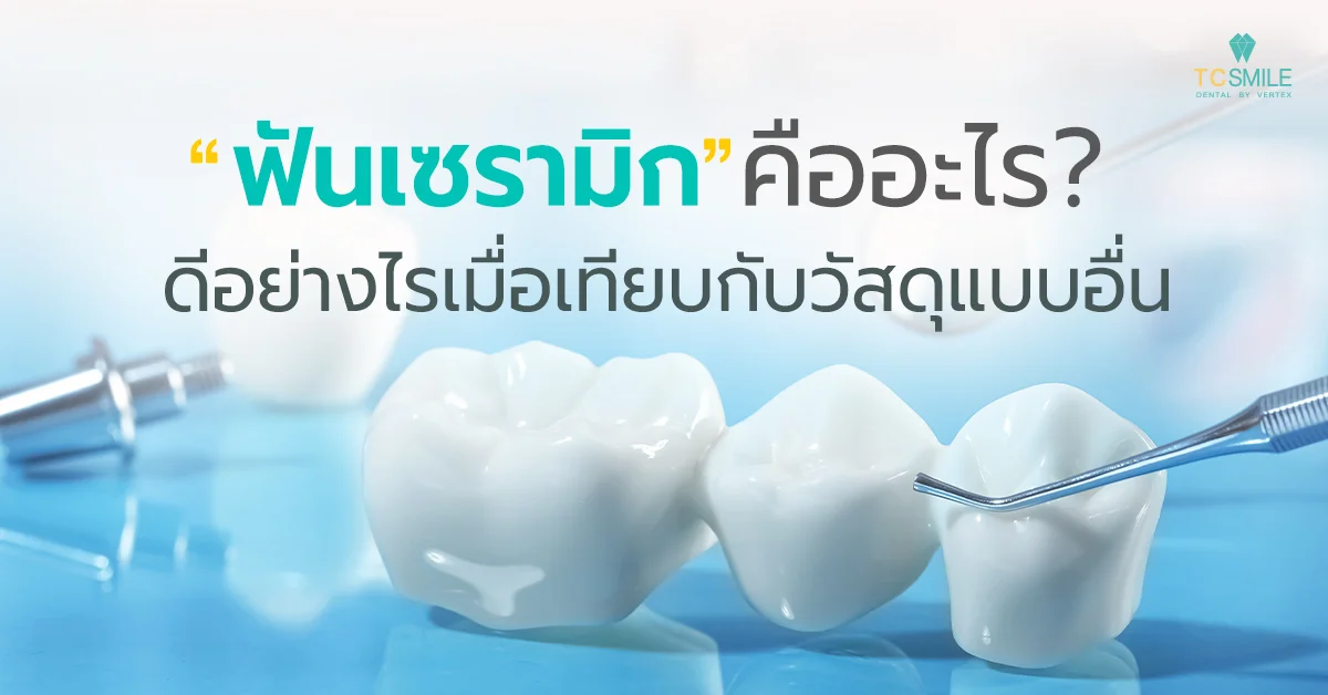 ฟันเซรามิกคืออะไรดีอย่างไร