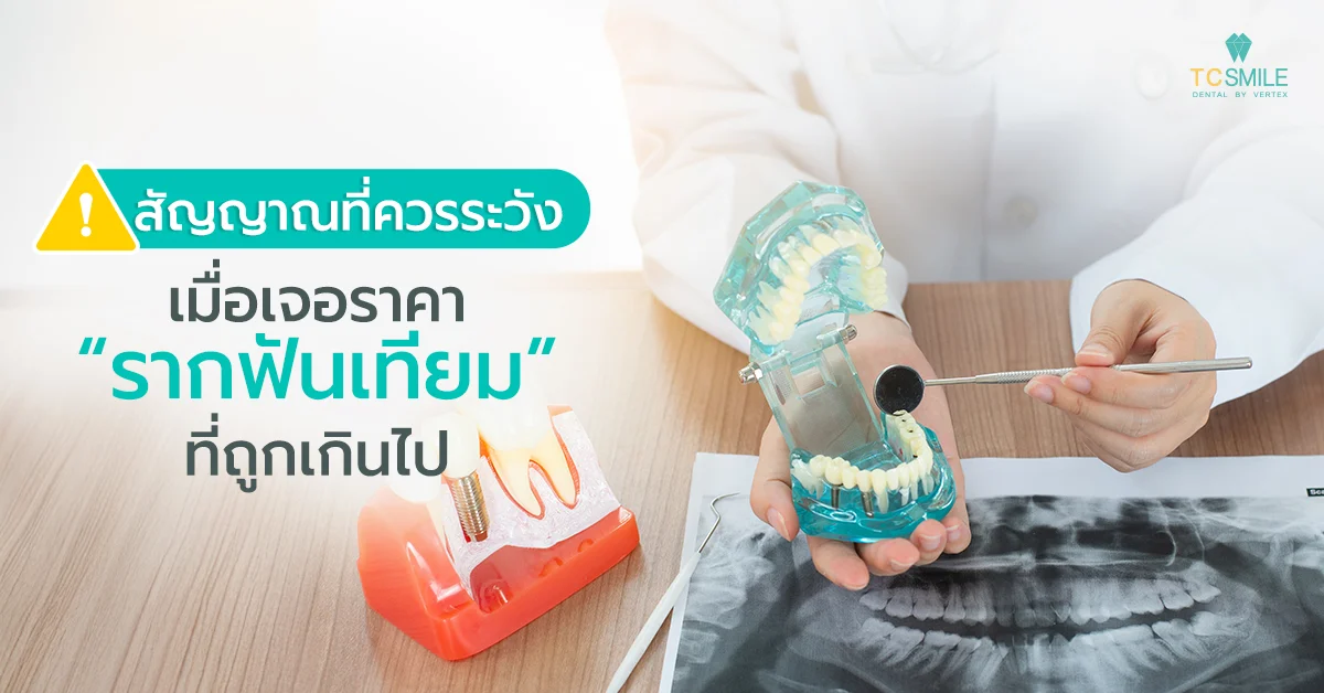 สัญญาณที่ควรระวังเมื่อเจอราคารากฟันเทียมถูกเกินไป