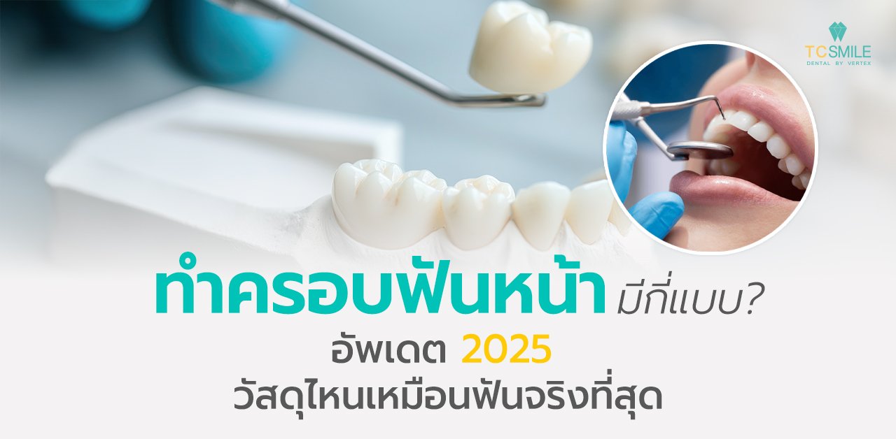 ทำครอบฟันหน้ามีกี่แบบอัปเดต 2025 วัสดุไหนเหมือนฟันจริงที่สุด