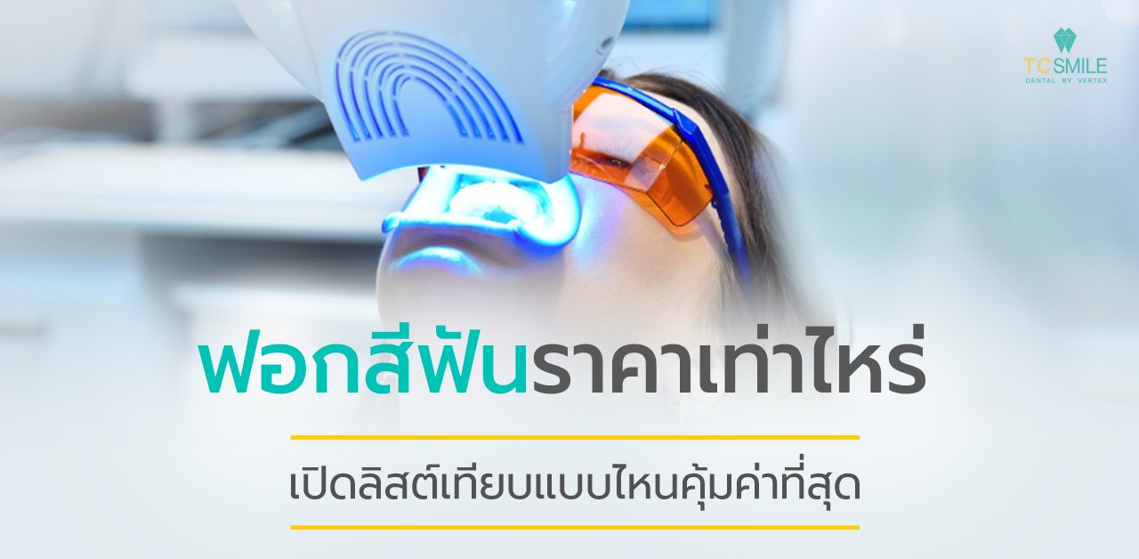 ฟอกสีฟันราคาเท่าไหร่ เปิดลิสต์เทียบแบบไหนคุ้มค่าที่สุด