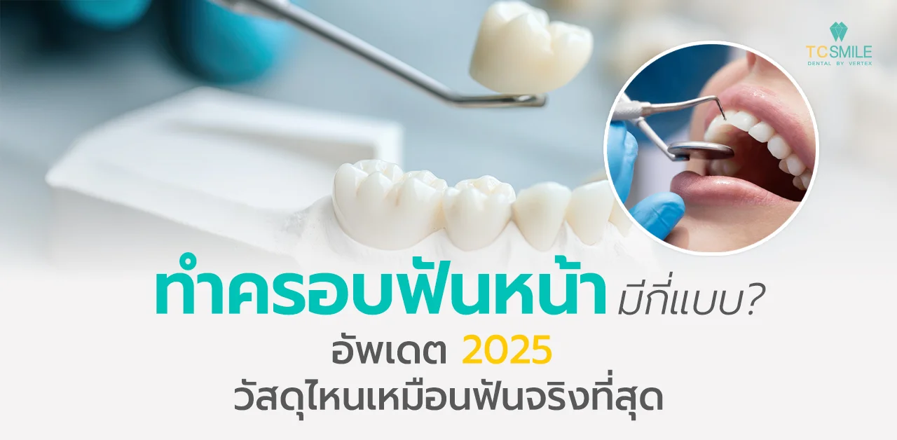 ทําครอบฟันหน้ามีกี่แบบ อัพเดต 2025
