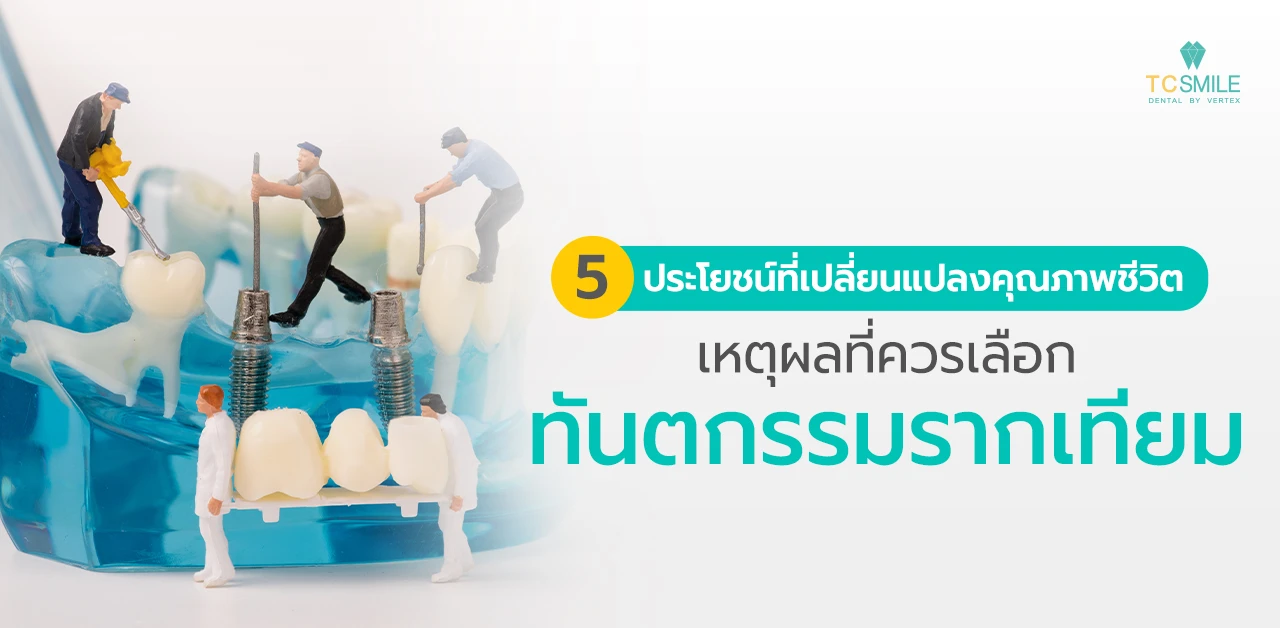 5 ประโยชน์ที่เปลี่ยนแปลงคุณภาพชีวิต