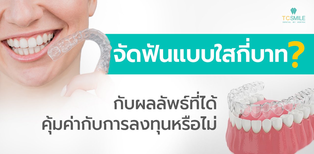จัดฟันแบบใสกี่บาทกับผลลัพธ์ที่ได้ คุ้มค่าการลงทุนหรือไม่