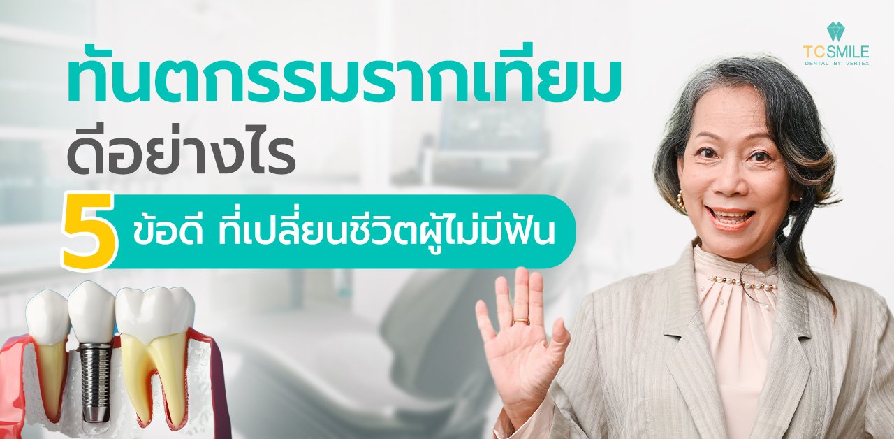 ทันตกรรมรากเทียมดียังไง 5 ข้อดีที่เปลี่ยนชีวิตผู้ไม่มีฟัน