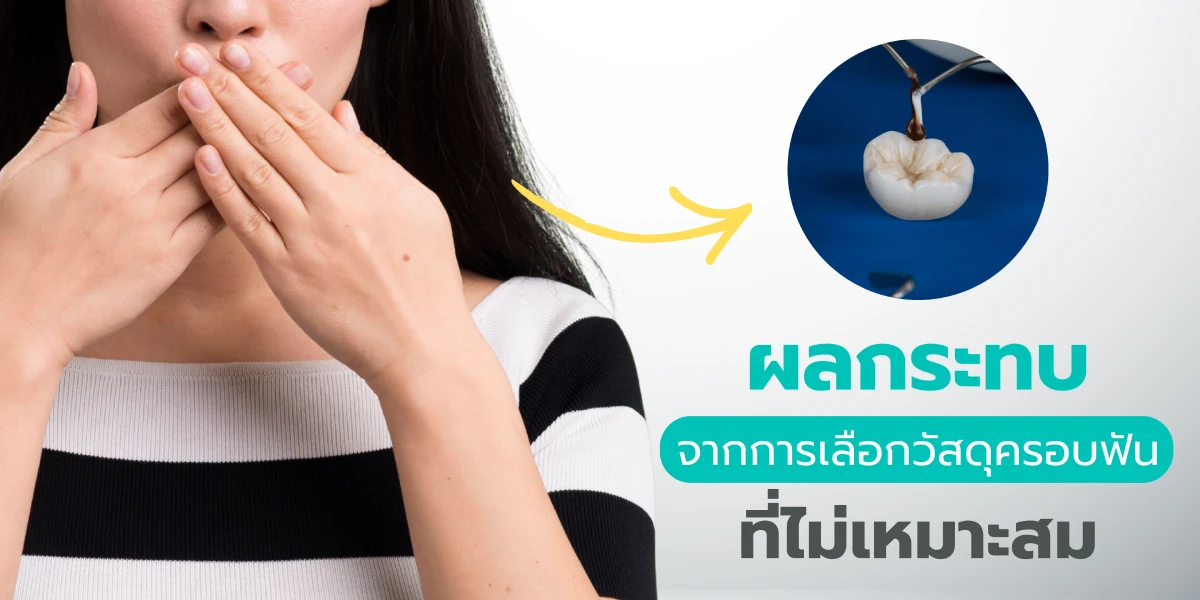 ผลกระทบที่ซ่อนอยู่เมื่อเลือกครอบฟันวัสดุที่ไม่เหมาะสม