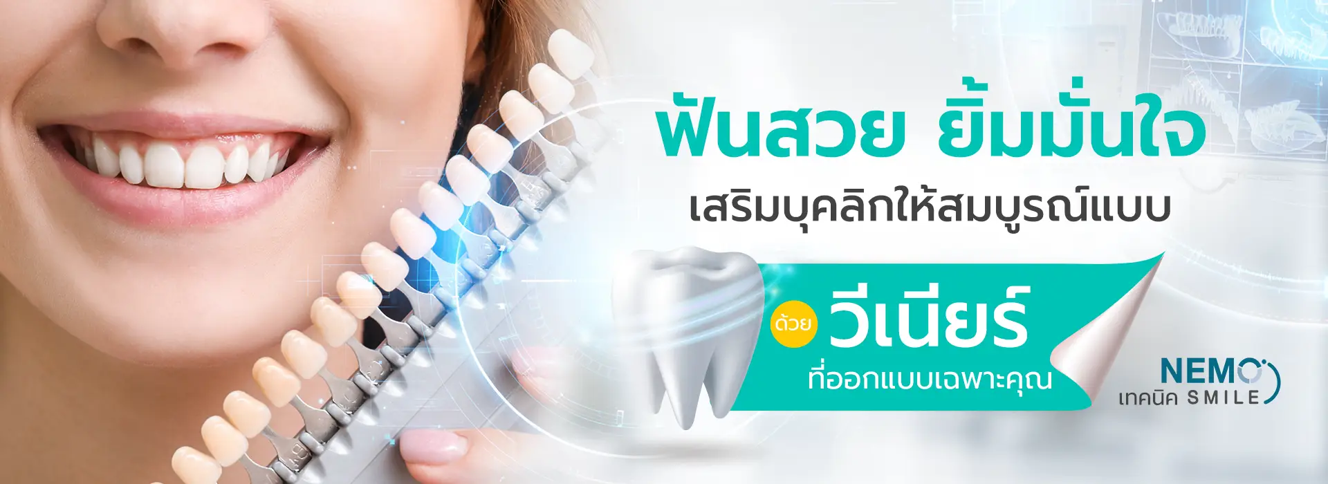 slide จัดฟันใส