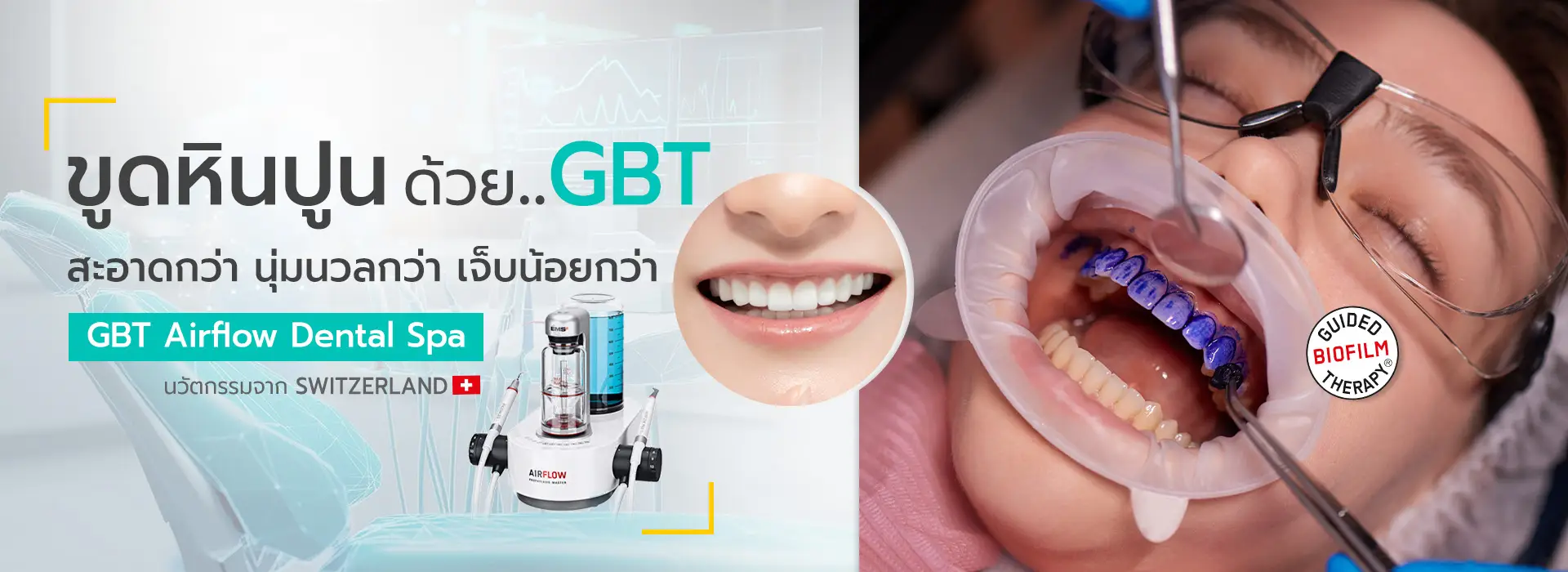 slide จัดฟันใส