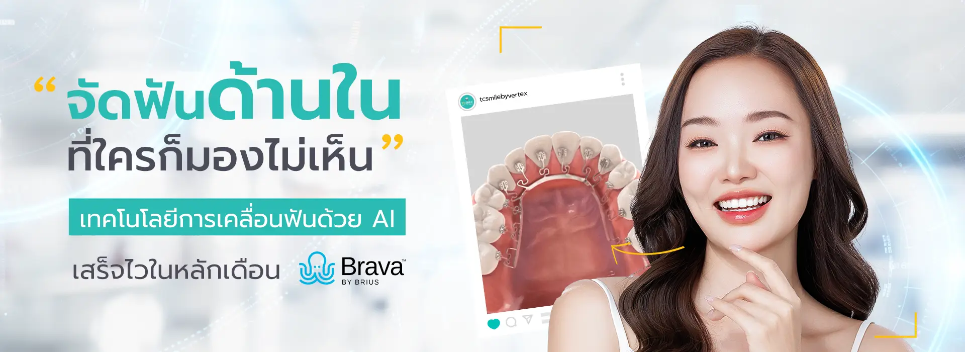 slide จัดฟันใส