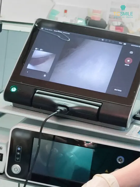 Nano TMJ ดูแลปัญหาข้อต่อขากรรไกร